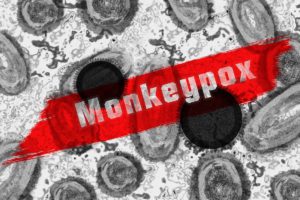 monkeypox in NSW